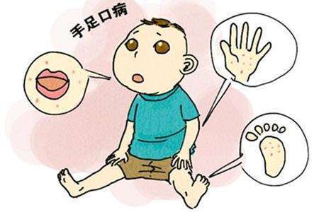 春意盎然，勿忘防治手足口